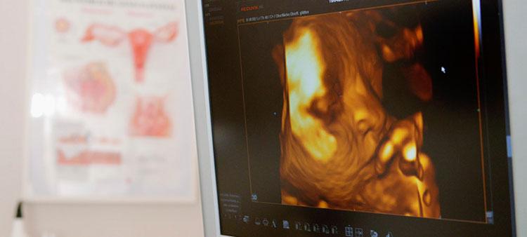 Praxis Frauenheilkunde und Geburtshilfe: Dr. Susann Ehrich und Dipl.-Med. Torsten Ehrich | Friedrichshain Berlin 10247 > 3D / 4D-Ultraschall
